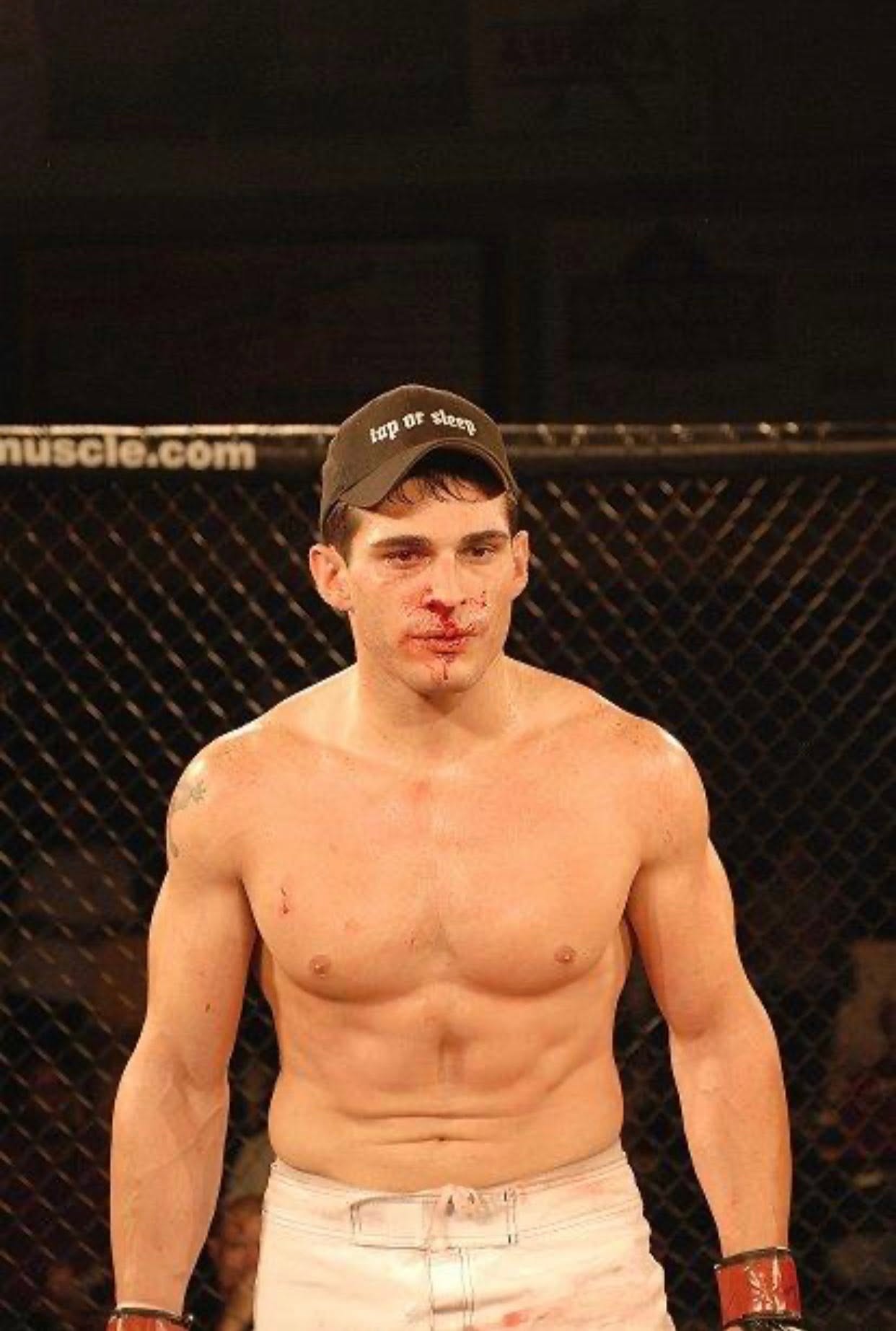 Louis Armezzani after a professional MMA bout